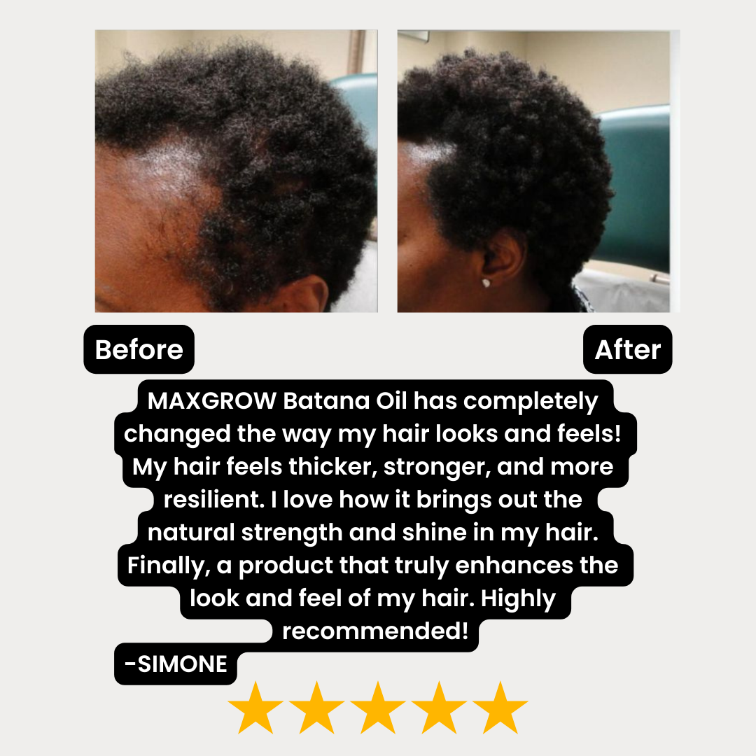 100% Unrefined Batana Oil - 4 oz