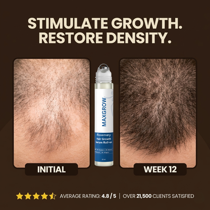 Maxgrow Hair Growth Roll On Serum