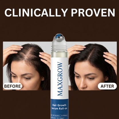 Maxgrow Hair Growth Roll On Serum