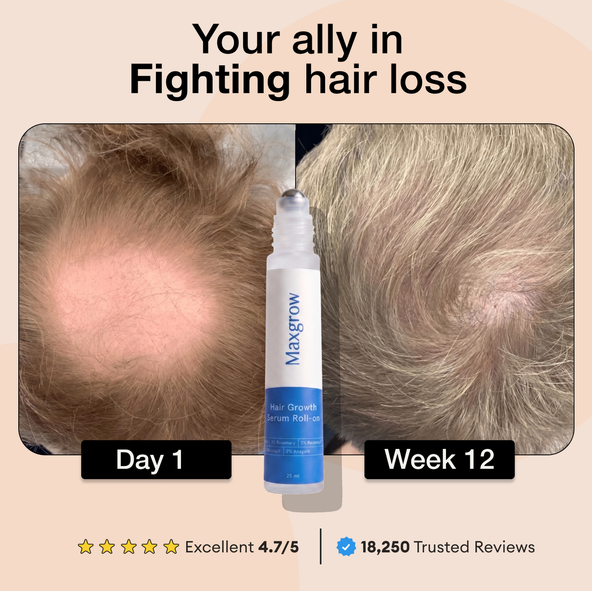 Maxgrow Hair Growth Roll On Serum