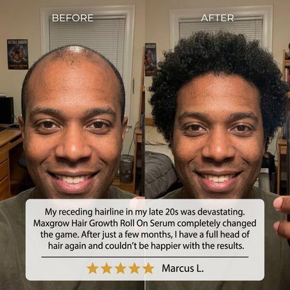 Maxgrow Hair Growth Roll On Serum