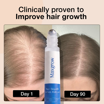 Maxgrow Hair Growth Roll On Serum