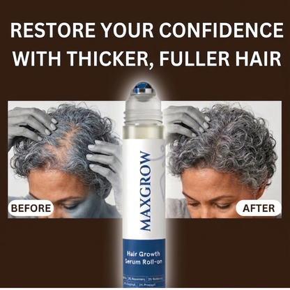Maxgrow Hair Growth Roll On Serum