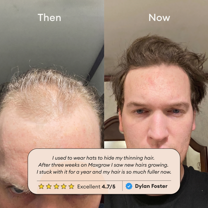 Maxgrow Hair Growth Roll On Serum