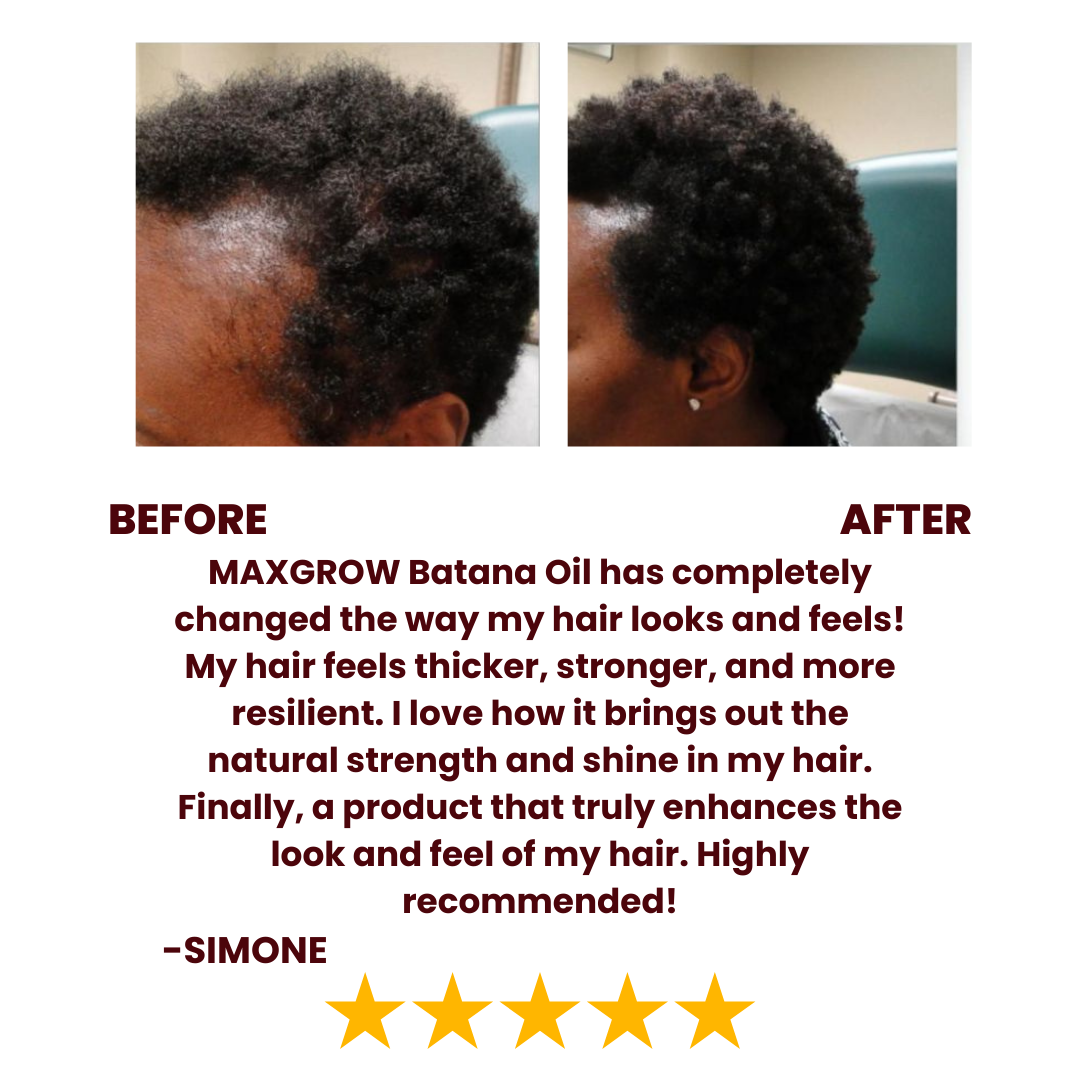 Batana Natural Hair Growth Oil