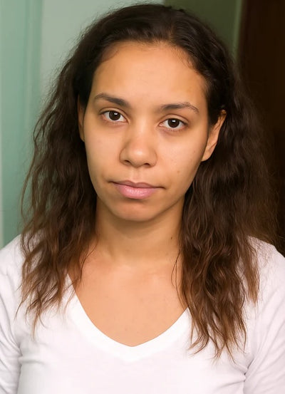 Before treatment result