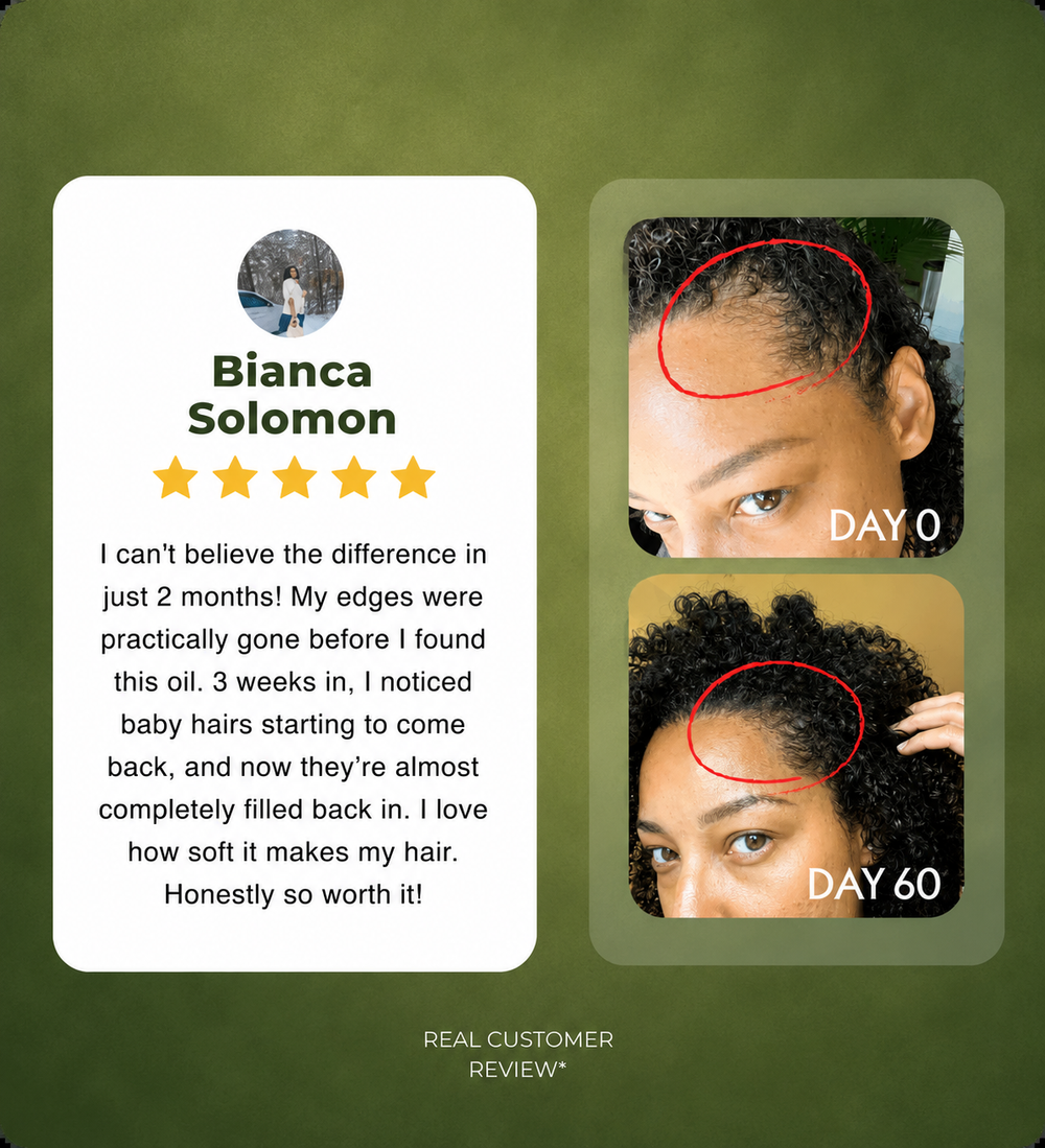 Batana Natural Hair Growth Oil®