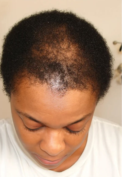 Before treatment result