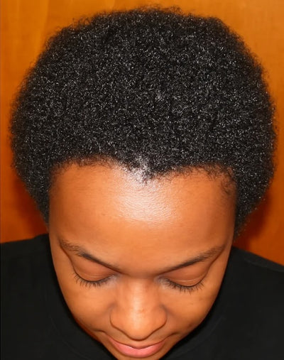 After treatment result