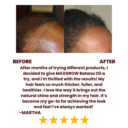 Batana Natural Hair Growth Oil®