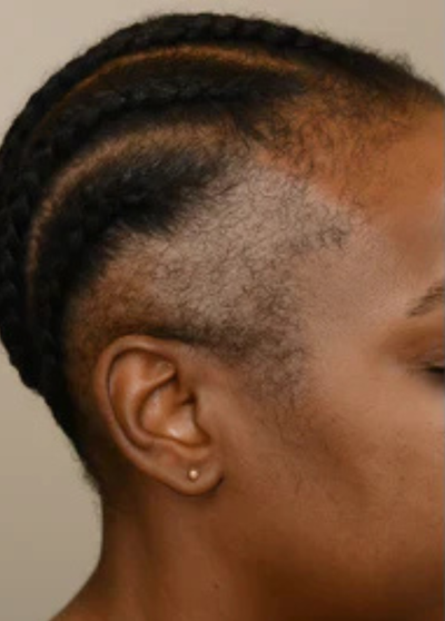 Before treatment result